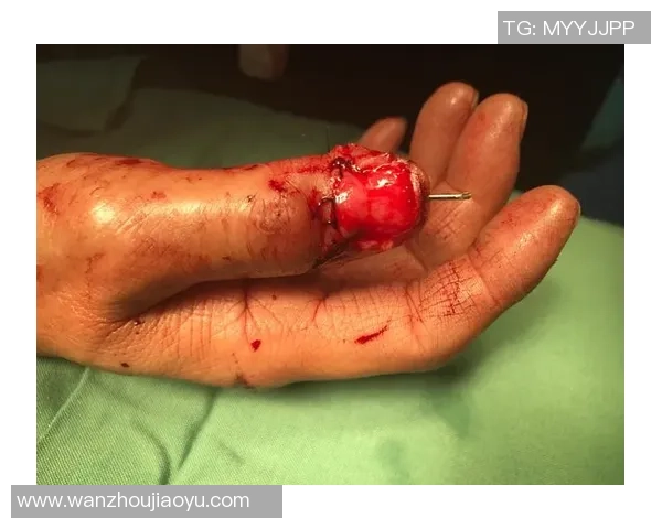 足球场上的咬人事件揭秘哪位明星球员曾因咬人而引发争议